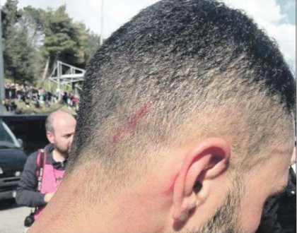 Giocatori del Taranto colpiti con una cazzottiera nell’intervallo della partita contro il Picerno Giocatori del Taranto colpiti con una cazzottiera nell’intervallo della partita contro il Picerno