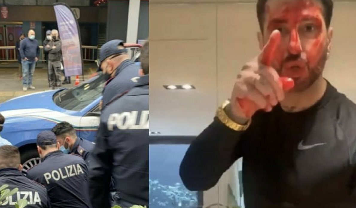 Disposta perizia psichiatrica per Fabrizio Corona: aggredì un agente della  Polizia e distrusse un'ambulanza. - Il Corriere del Giorno